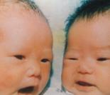 广东省首例试管婴儿诞生